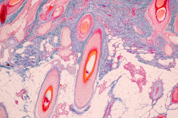 Scalp Hair Follicles Human Microscope Lab — Stock Photo, Image