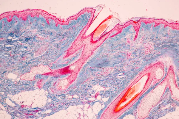 研究室での顕微鏡下でのヒトの頭皮と毛包 — ストック写真