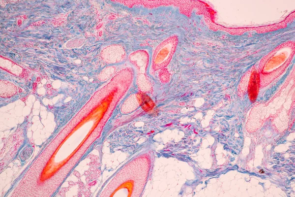 Scalp and hair follicles of human under the microscope in Lab.