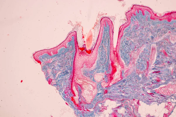 Skalp Vlasové Folikuly Člověka Pod Mikroskopem Laboratoři — Stock fotografie