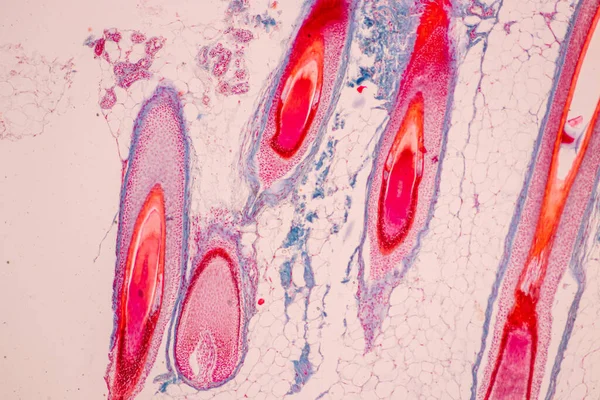 Scalp and hair follicles of human under the microscope in Lab.