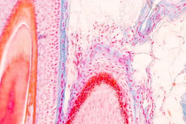 研究室での顕微鏡下でのヒトの頭皮と毛包 — ストック写真