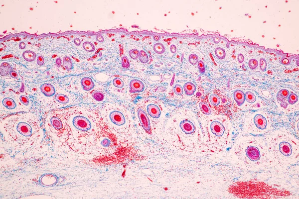 研究室での顕微鏡下でのヒトの頭皮と毛包 — ストック写真