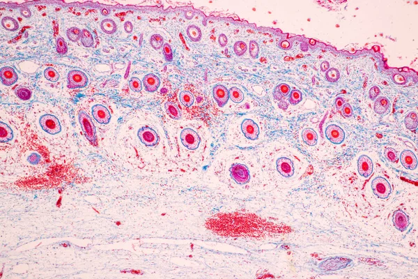 Cuero Cabelludo Los Folículos Pilosos Del Ser Humano Bajo Microscopio —  Fotos de Stock