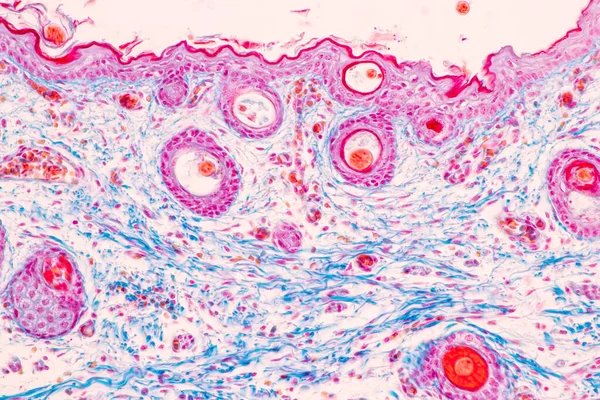 Skalp Vlasové Folikuly Člověka Pod Mikroskopem Laboratoři — Stock fotografie