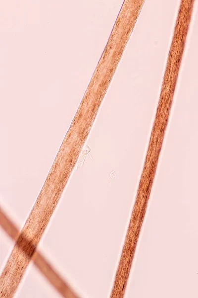 Scalp and hair follicles of human under the microscope in Lab.