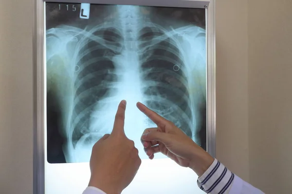 Ofiste Röntgen Görüntüsüne Bakan Iki Tıp Doktoru — Stok fotoğraf