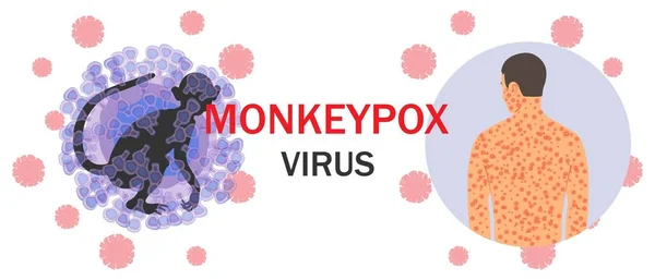 带有猴痘病毒细胞 猴轮廓 文字和人体皮疹的条幅具有微生物学背景 病毒性疾病的概念及其症状 矢量说明 — 图库矢量图片