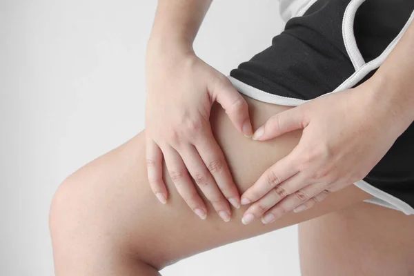 Young Woman Holding Pushing Skin Legs Cellulite Orange Peel Body — Stockfoto