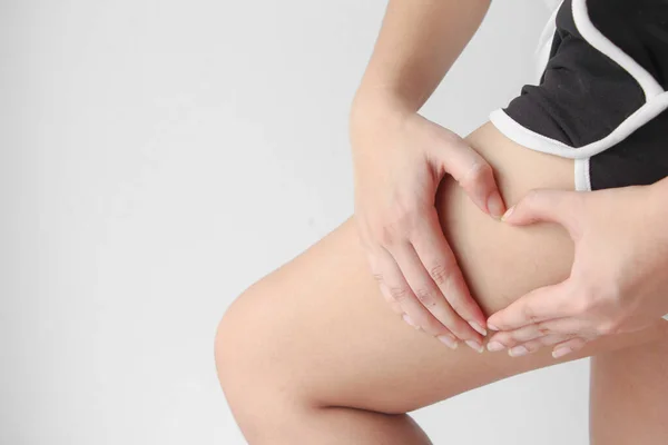 Young Woman Holding Pushing Skin Legs Cellulite Orange Peel Body — Stockfoto