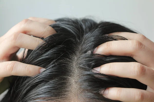 Közelkép Ázsiai Emberek Fejéről Hosszú Fekete Haja Van Problémái Vannak — Stock Fotó