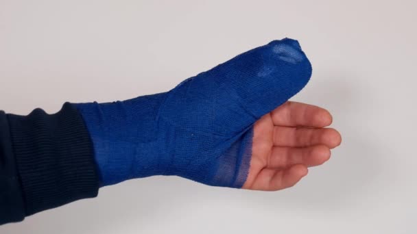 Bandaged hand.Surgical dressing. Broken arm. Blue surgical bandage on the arm on a white background. Medicine concept. Fractures and sprains. Bandages and bandages. — Wideo stockowe