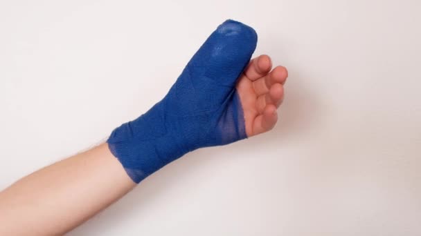 Bandaged hand.Surgical dressing.Blue surgical bandage on the arm — стоковое видео