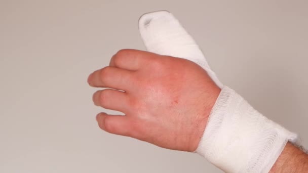 Bandagen und Schiene am Arm, gebrochener Arm, Bandage und Schiene am Finger, bandagierte Hand, Frakturen und Verstauchungen. Medizinkonzept. Chirurgischer Verband. — Stockvideo