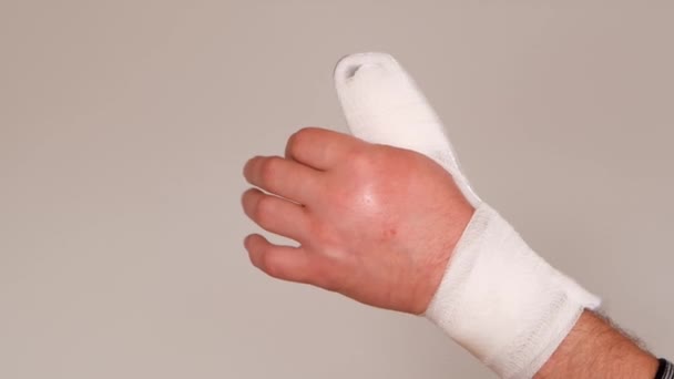 Bandage och en spjäla på armen .Bruten arm.Bandage och spjäla på fingret. — Stockvideo