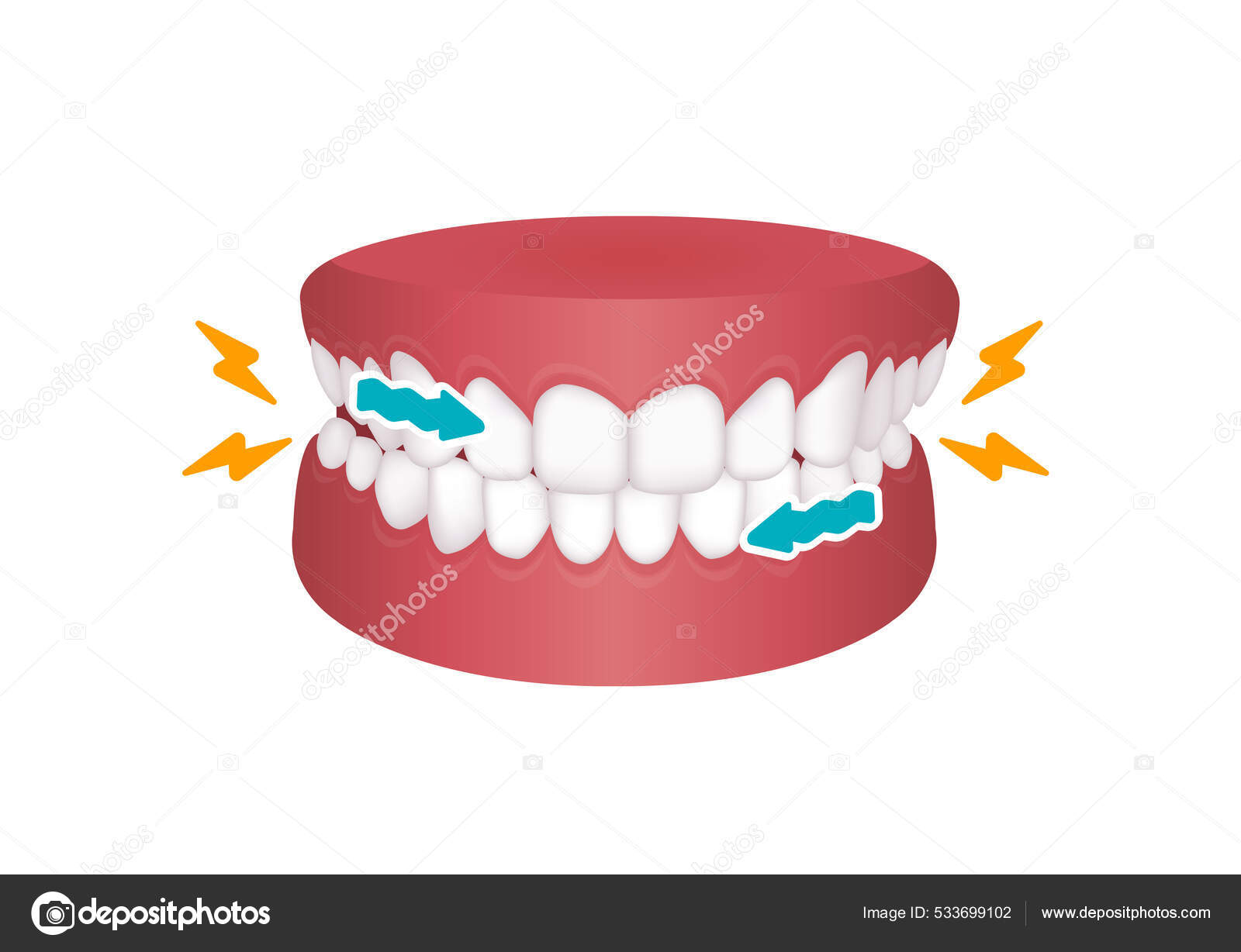 Bruxism Vector Illustration Grinding Teeth Stock Vector Image by ??barks