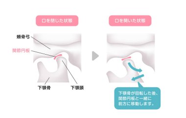 Çene açılıp kapatılırken yapısal resimleme