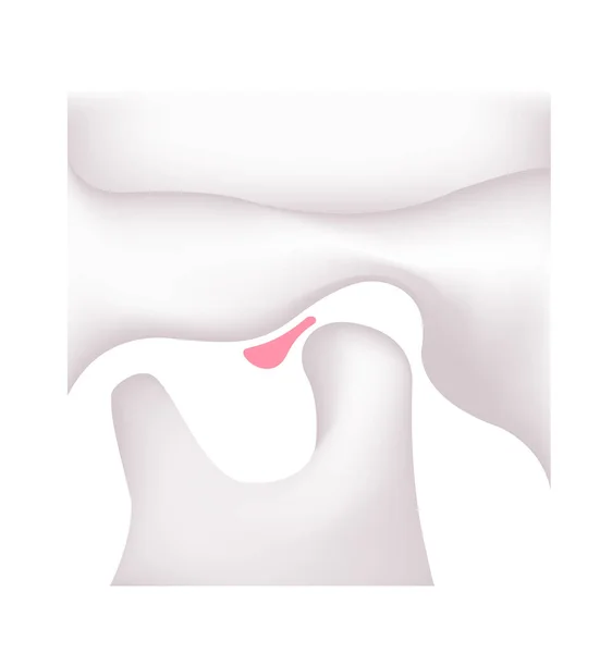 人間の顎の構造図 顎関節症 Tmd — ストックベクタ