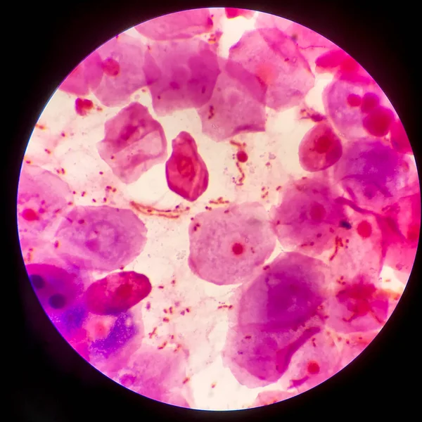Röda Blodkroppar Bakteriecell Gram Neagative Bacilli Med Kapselpatogen Prov Sputum — Stockfoto
