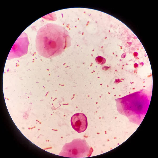 Globuli Rossi Cellule Batteriche Bacilli Gram Neagativi Con Patogenicità Della — Foto Stock