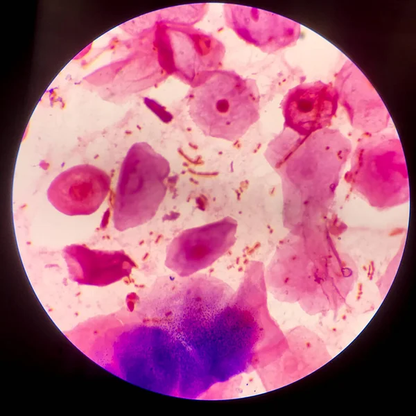 Red Cells Bacteria Cell Gram Neagative Bacilli Capsule Pathogen Sample — Stock Photo, Image