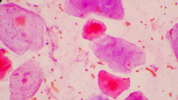 Vörösvértestek Bakteriális Sejt Gram Neagatív Bacillusok Kapszula Patogenitással Minta Köpet — Stock Fotó