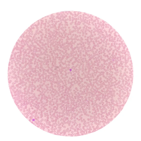 Globuli Rossi Nello Striscio Sangue Trovano Con Microscopio 40X Sfondo — Foto Stock