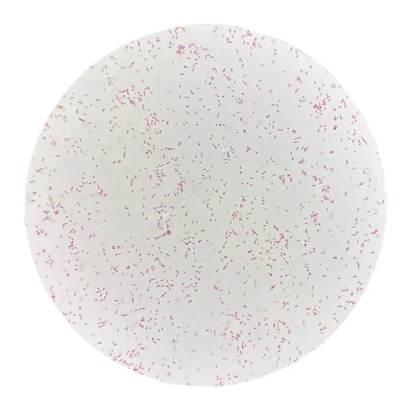 Bakterienzellenfund Mit Mikroskop Labor — Stockfoto