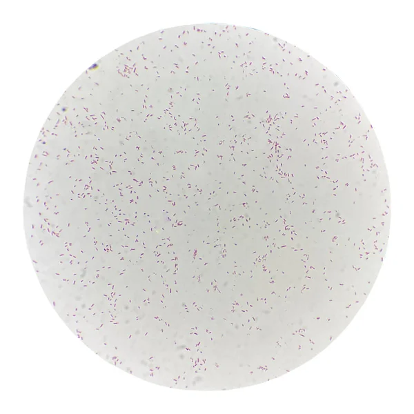 Hallazgo Células Bacterianas Con Microscopio Laboratorio — Foto de Stock