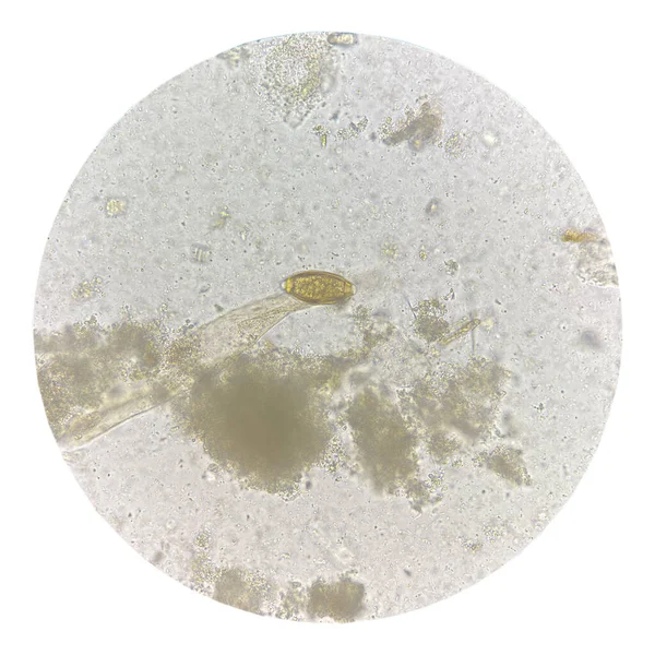 粪便检查实验室概念中的寄生虫蛋 — 图库照片