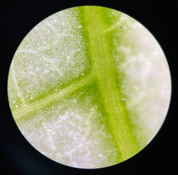 显微镜下发现青光眼植物细胞 — 图库照片