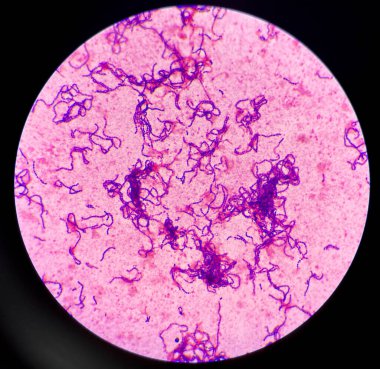 Bacteria Gram positive cocci in chain.