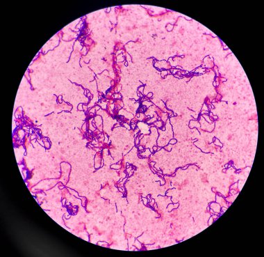 Bakteri Gram zinciri içinde pozitif kokain.