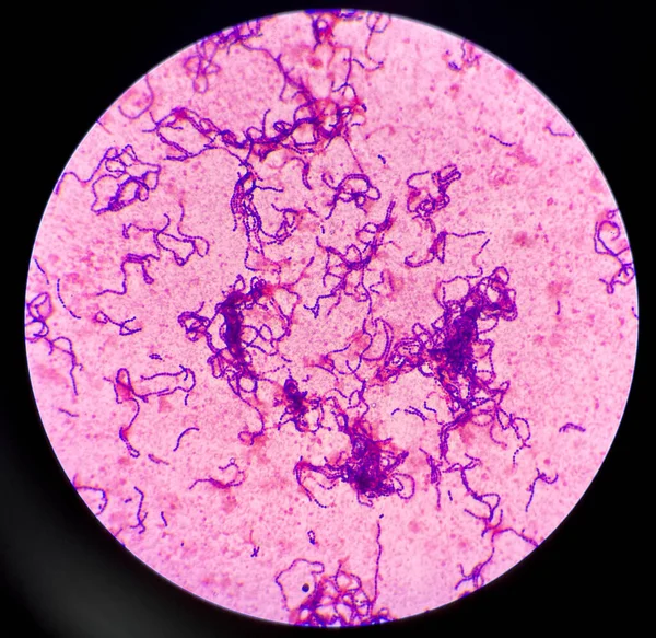 Bacteria Gram Positive Cocci Chain —  Fotos de Stock