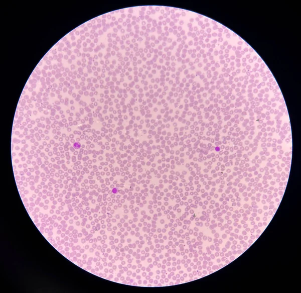 Red blood cell and white blood cells in 40X microscope Laboratory concept.