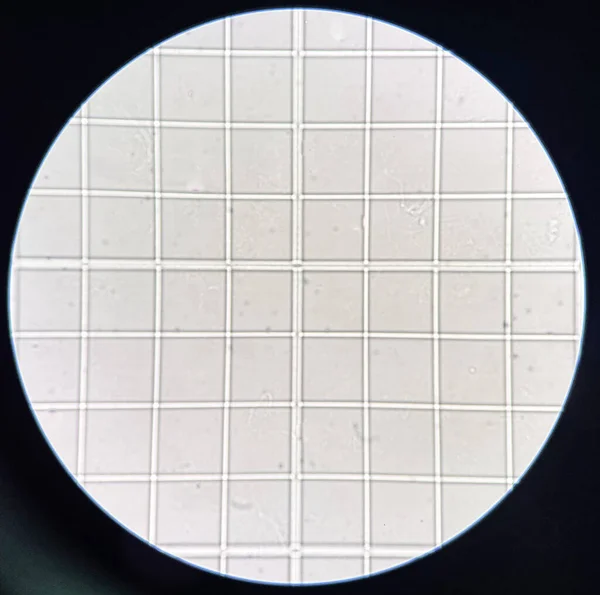 Urine Sediment Scale Finding Microscope Laboratory —  Fotos de Stock