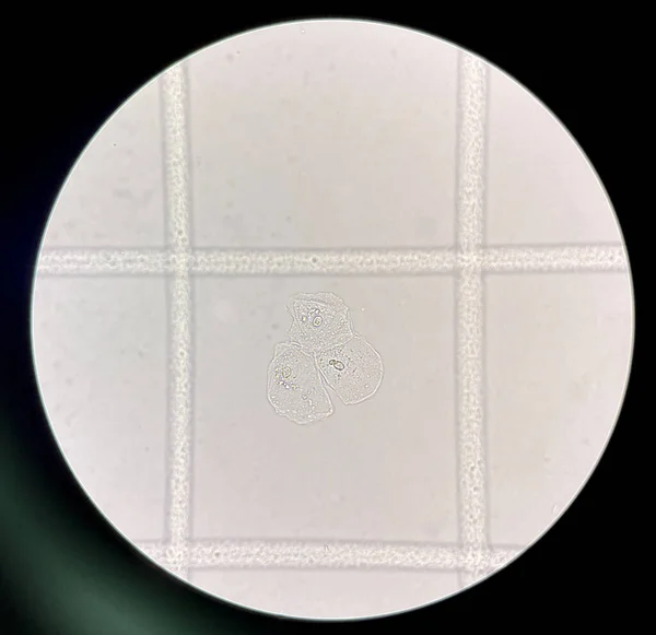 Scale Urine Reader Finding Sediment Squamous Epithelial Cells — Foto de Stock