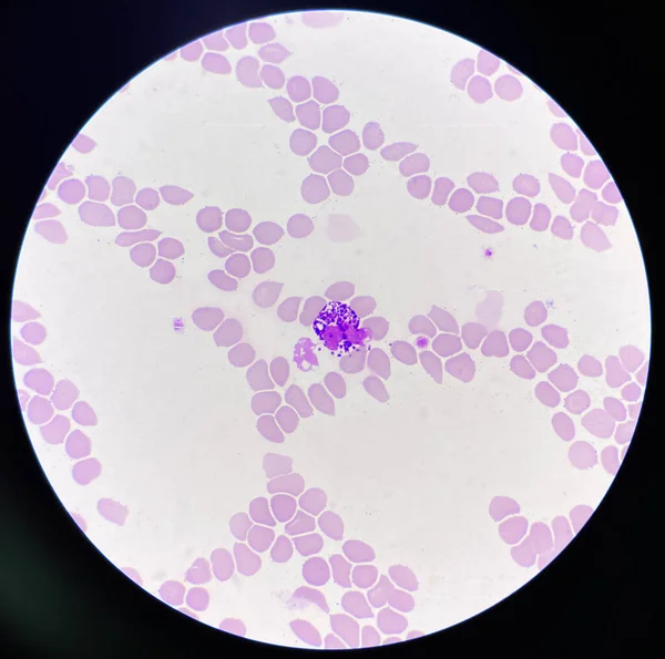 Glóbulos Brancos Basófilo Sobre Fundo Glóbulos Vermelhos — Fotografia de Stock
