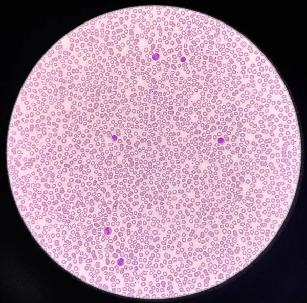 Normochromic Normocytic Rbc Blood Smear 40X Microscope — 图库照片