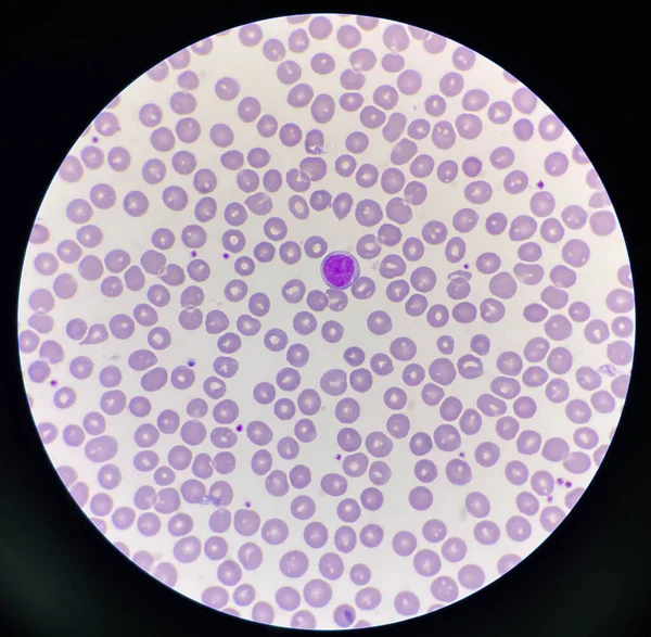 Normokróm Normocitikus Rbc Vérkenet 100X Mikroszkóp — Stock Fotó