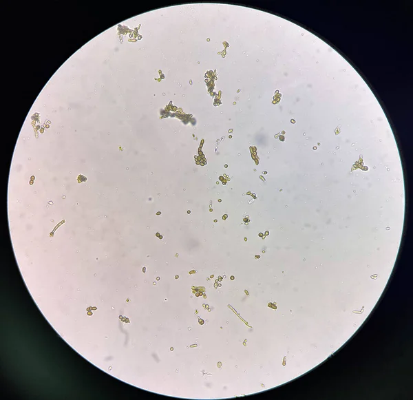Budding yeast cell in nature find with microscope.