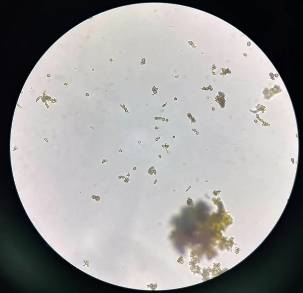 Budding Κύτταρα Ζύμης Στη Φύση Βρείτε Μικροσκόπιο — Φωτογραφία Αρχείου