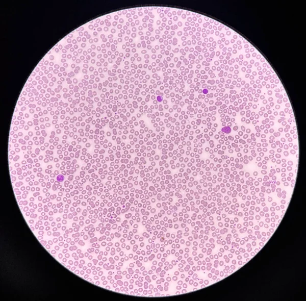 Microscopio Rbc Normocromico Normocitico Striscio Sangue 40X Immagine Stock