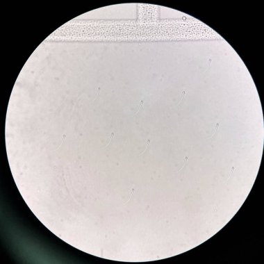 Laboratuvarda idrar tortularında taze sperm..