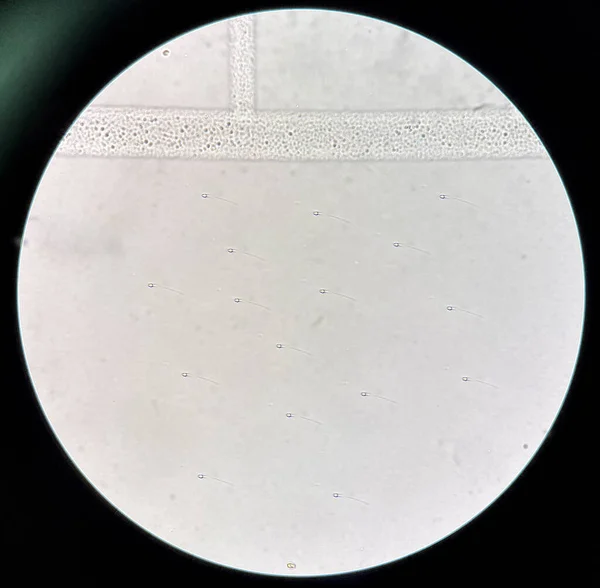 Frische Spermien Urinsediment Labor — Stockfoto