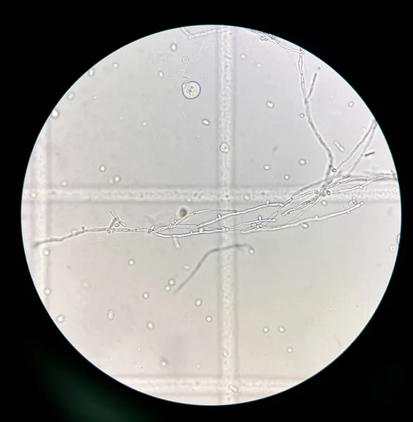 Зарождающиеся Дрожжевые Клетки Псевдогифами Образце Мочи Помощью Микроскопа 40X — стоковое фото