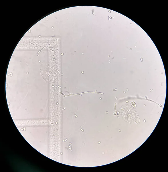 Células Levadura Formación Con Pseudohifas Muestra Orina Hallazgo Con Microscopio — Foto de Stock