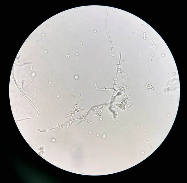 Budding yeast cells with pseudohyphae in urine sample finding with microscope 40X