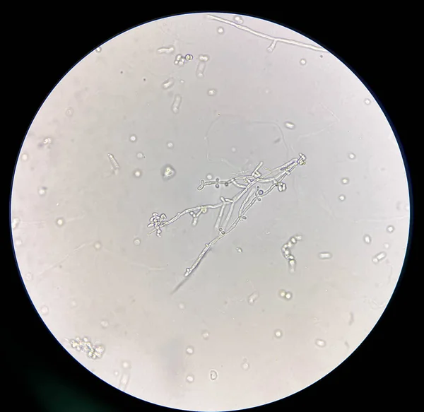 尿サンプル中に仮晶を持つ出芽酵母細胞を顕微鏡で観察 40X — ストック写真
