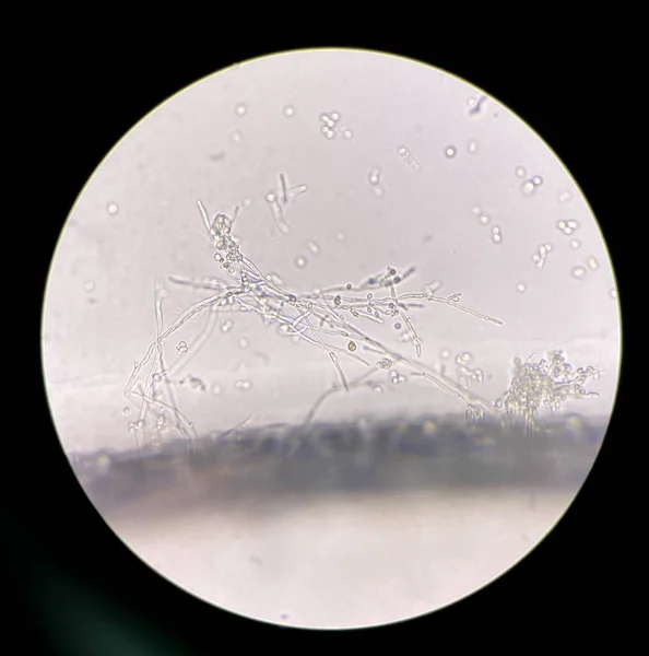 Knabbernde Hefezellen Mit Pseudohyphen Urinproben Unter Dem Mikroskop 40X — Stockfoto